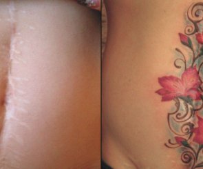 исправление татуировок исправленные татуировки киев