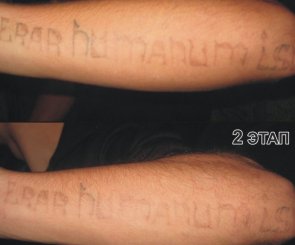 удалить татуировку киев фото до и после свести тату