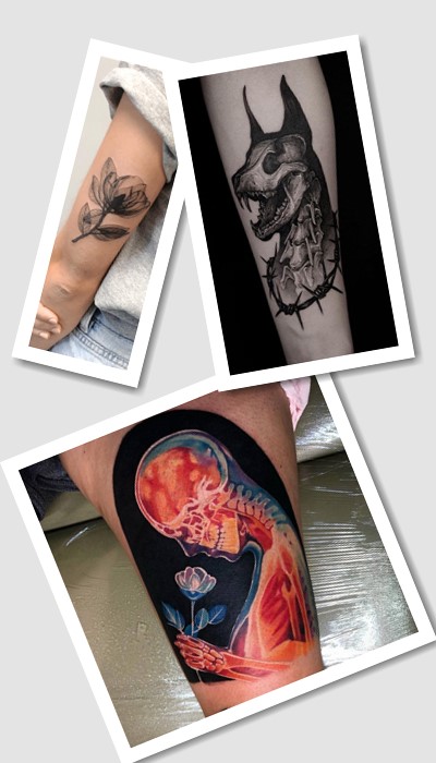 тату Рентген