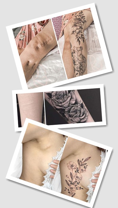 тату на шрамах