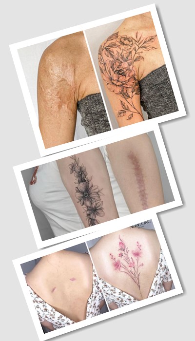 татуювання На шрамах