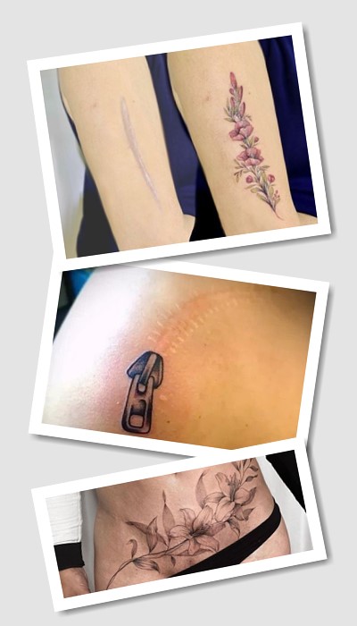 стиль тату На шрамах