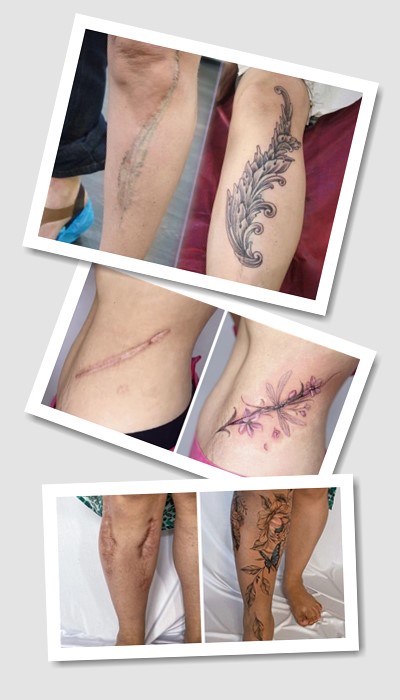 стиль татуювання На шрамах