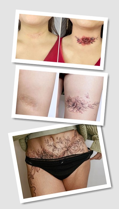 особливості татуювань На шрамах