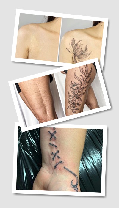 кому підійде тату На шрамах