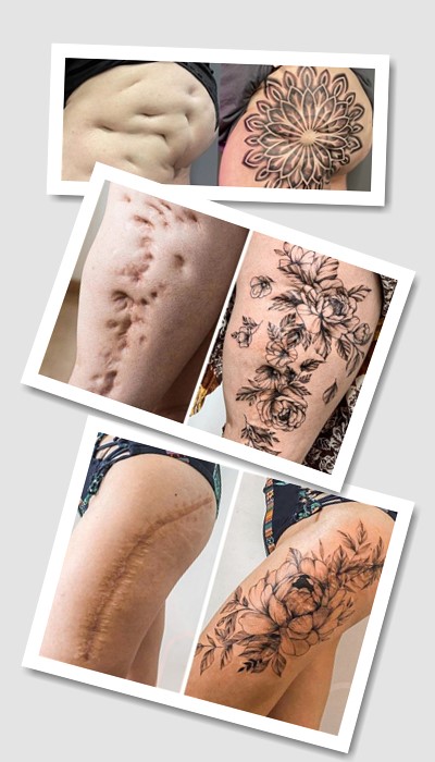 кому підійде татуювання На шрамах