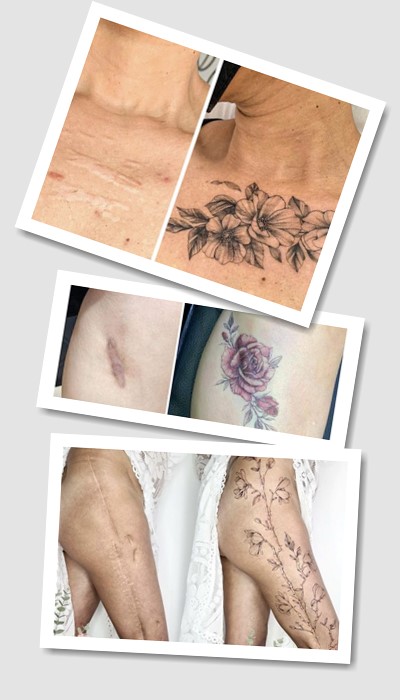 ідеї татуювання На шрамах