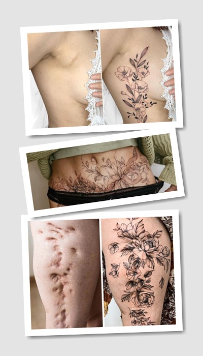 тату на шрамах