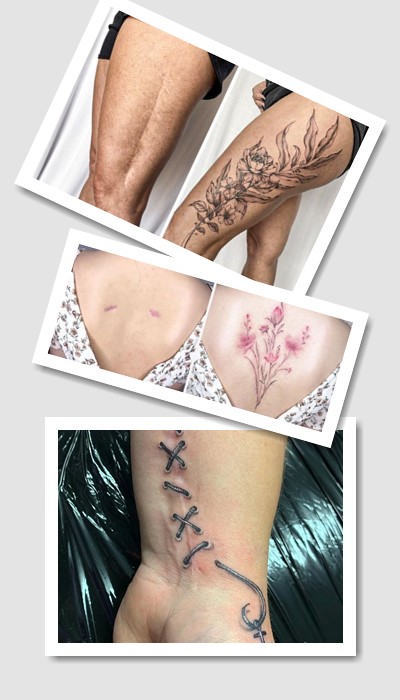 стиль татуювання На шрамах