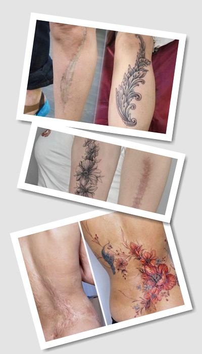 особливості татуювань На шрамах