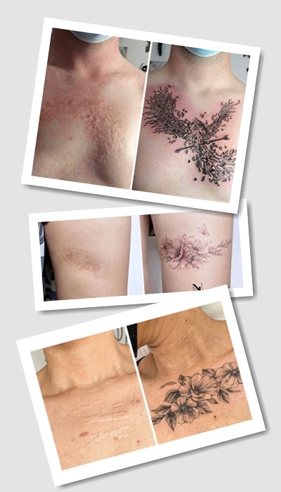 кому підійде тату На шрамах