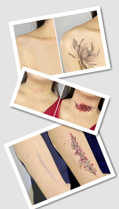 кому підійде татуювання На шрамах