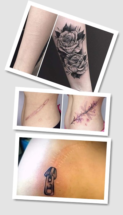 ідеї татуювання На шрамах