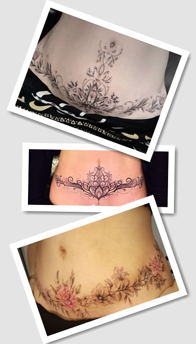 тату на шрамі від кесаревого
