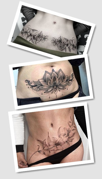 стиль татуювання На шрамі від кесаревого