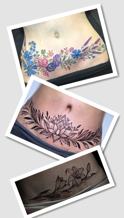 кому підійде татуювання На шрамі від кесаревого