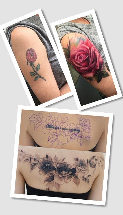 що робити з партаком татуюванням