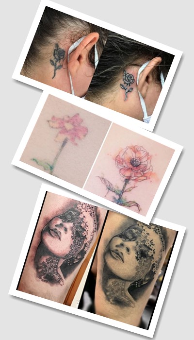 корекція татуювання