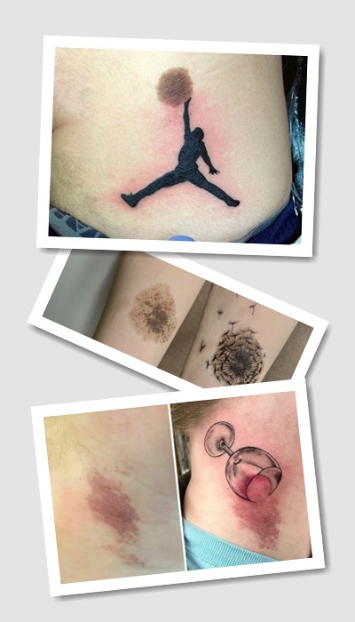 ідеї тату на родимій плямі