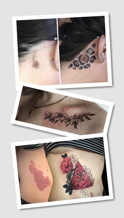 ідеї татуювань на родимій плямі 