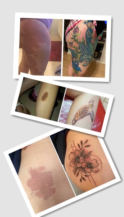 особливості тату на родимій плямі