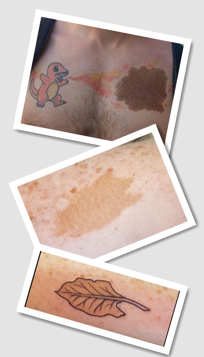 тату на родимій плямі