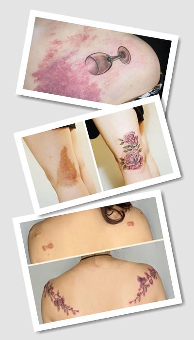 татуювання на родимій плямі