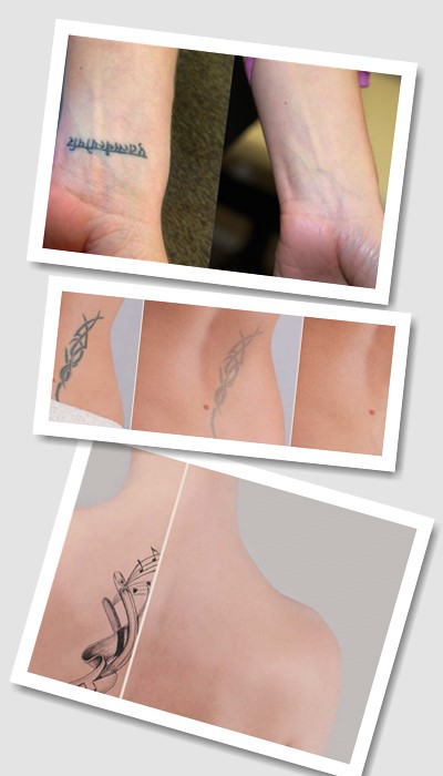 чи існують тимчасові тату