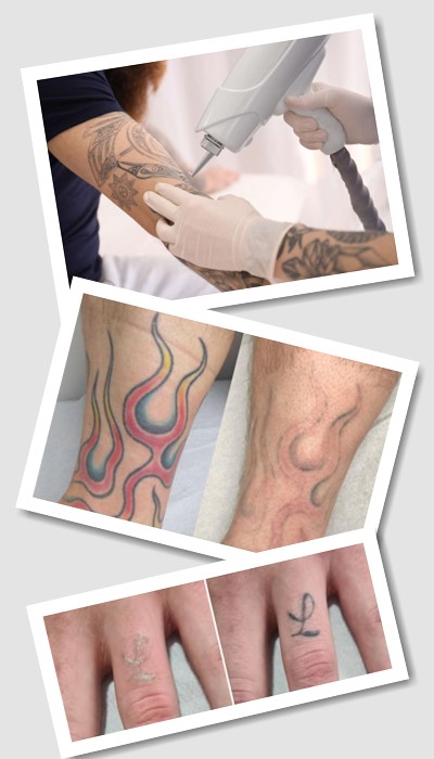 чи існують тимчасові татуювань