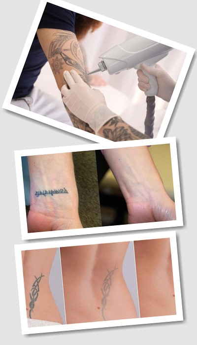 чи існують тимчасові татуювань