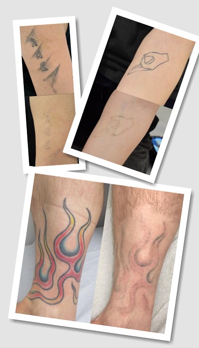 чи існують тимчасові татуювань