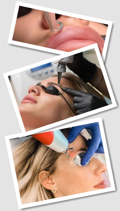 Як видаляють татуаж