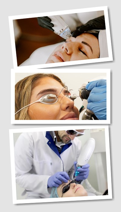 Видалити Татуаж у Києві