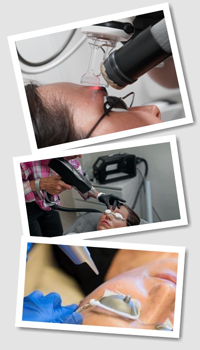 Видалити Перманентний макіяж у Києві