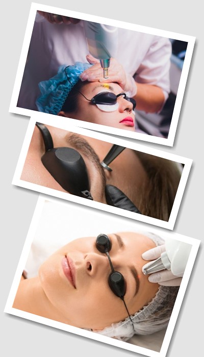 Як Видалити татуаж