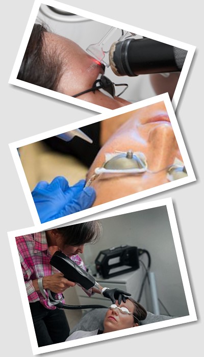 Видалити Перманентний макіяж на обличчі