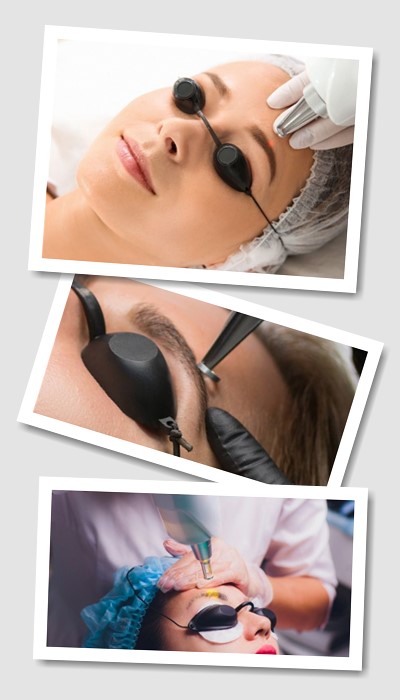 Видалити Татуаж у Києві