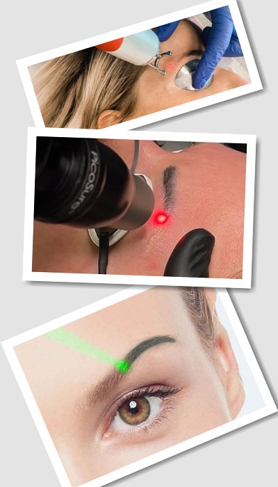 Видалити Перманентний макіяж у Києві