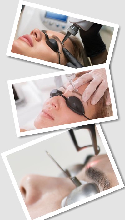 Як Видалити татуаж