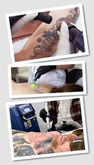 Виведення тату