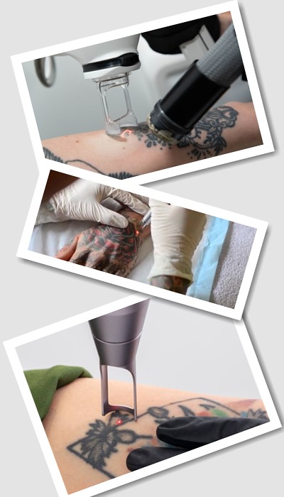 Виведення татуювань