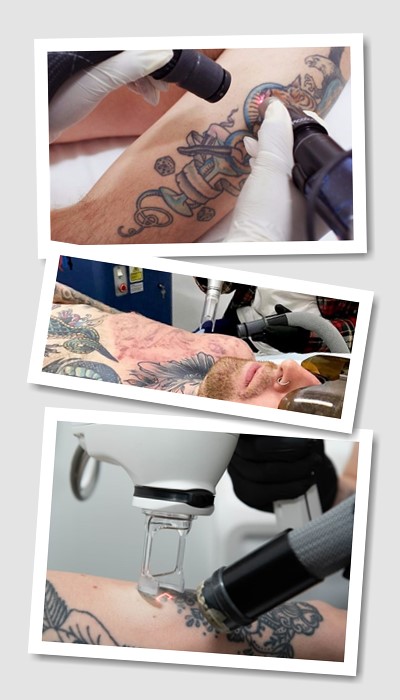 Виведення татуювань