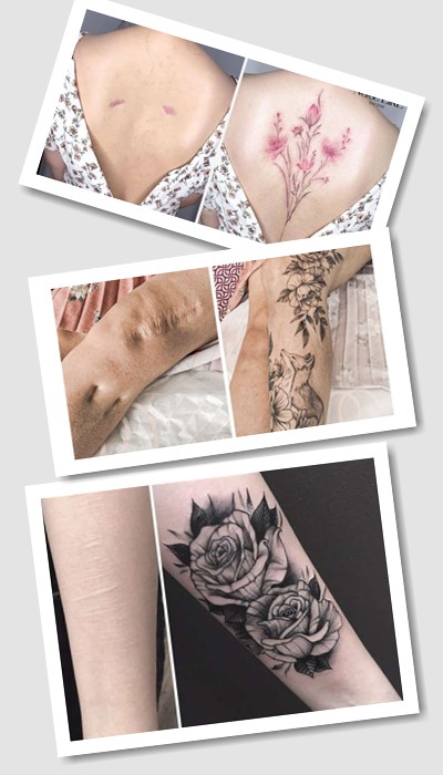 тату на шрамах