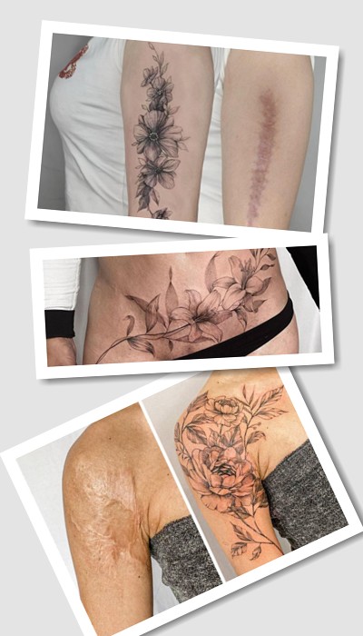 татуювання на шрамах