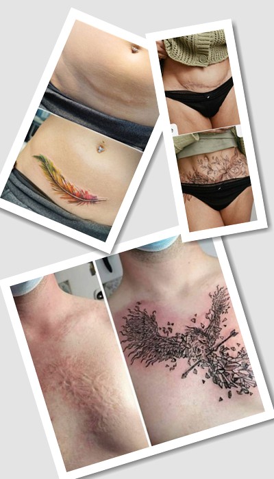 замаскувати шрам татуюванням