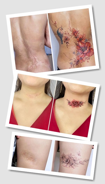 перекрити шрам тату