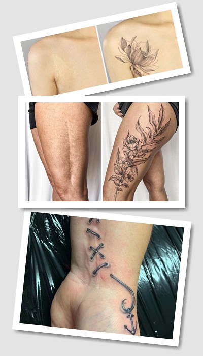 перекрити шрам татуюванням